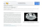 ¿Cuál es su diagnóstico?X(1)S(rhw20jcpbsbrc… · implicación de la médula ósea Síndrome de POEMS Amiloidosis sistémica primaria Mieloma múltiple latente Mieloma múltiple