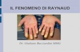 IL FENOMENO DI RAYNAUD - docvadis · Il fenomeno di Raynaud si caratterizza per ... avrebbe preso il suo nome osservando le mani di alcune giovani fioraie parigine che d'inverno rimanevano