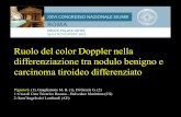 Ruolo del color Doppler nella differenziazione tra nodulo benigno e · 2020-04-06 · Ruolo del color Doppler nella differenziazione tra nodulo benigno e carcinoma tiroideo differenziato