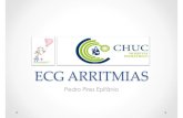 3º curso cardiologia pediatrica - ECG arritmias · 3º curso cardiologia pediatrica - ECG arritmias.pdf Created Date: 3/2/2016 11:48:13 PM ...