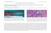 Adenocarcinoma de esófago 36 años después de una …scielo.isciii.es/pdf/diges/v99n7/imagenes1.pdfVarón de 36 años con disfagia a sólidos de 3 meses de evolución. Como antecedente