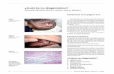 ¿Cuál es su diagnóstico?revistapediatria.com.ar/wp-content/uploads/2012/03/con311-p276.pdf · vos de caviar”. • Linfangioma o ... cos diferenciales. Comentario El diagnóstico