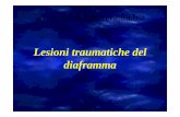Lesioni traumatiche del diaframma - Fisiokinesiterapia · Trauma chiuso toraco-addominale Lesione diaframmatica (rottura raggiata o lacerazione estesa e complessa) Ferita panetrante