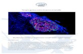 Terapia genica contro il cancro al cervello · 2017. 12. 20. · Terapia genica contro il cancro al cervello Risultati promettenti per trattamenti “mirati” contro il glioblastoma