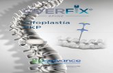 Cifoplastia PKP Overfix - bioadvance.com.mx€¦ · Desde nuestra sede operativa en Estados Unidos, y ﬁliales en México, Chile y Argentina, prestamos soluciones médicas a toda