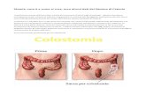 Stomia: cosa è e come si cura, ecco alcuni dati del Nesima di Catania · 2009. 9. 22. · Il tumore del colon‐retto è la seconda causa di morte rispetto a tutti i tipi di tumore