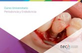 Curso Universitario Periodoncia y Endodoncia · 2020. 10. 19. · Este Curso Universitario en Periodoncia y Endodoncia contiene el programa científico más completo y actualizado