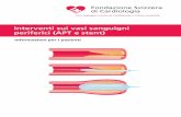 Interventi sui vasi sanguigni periferici (APT e stent)