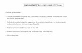 ANORMALITA' DELLE CELLULE EPITELIALI