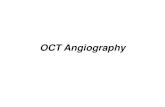 OCT Angiography: The Newest Frontier for the   vasi anomali nella retina esterna (e.g.: CNV in AMD) Il Significato del Segnale nelle immagini AngioVue . OCT-A e AMD