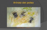 Artrosi del polso - Angiolini & DEL POLSO.  SLAC = scapho-lunate advance collapse 1. lesione inveterata